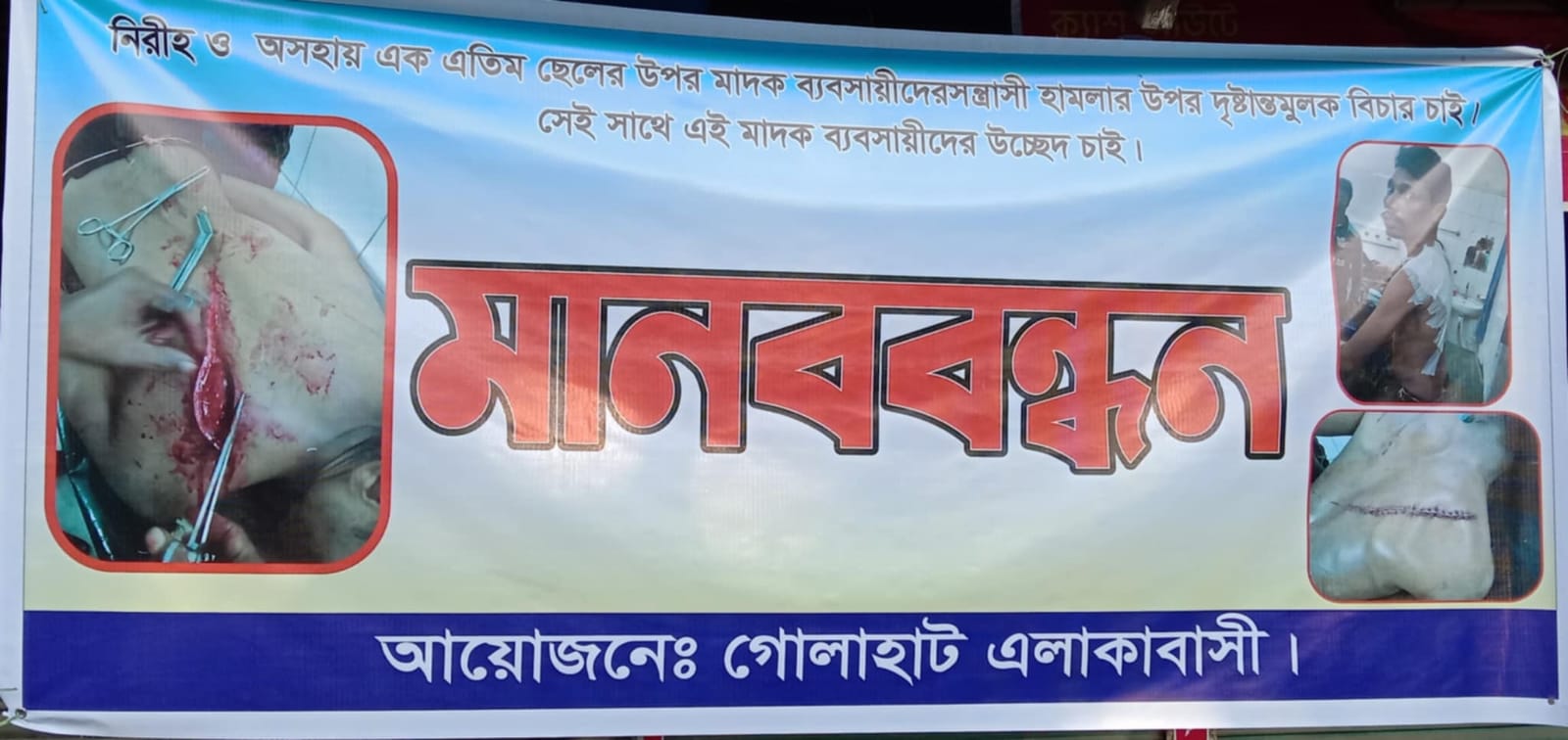 Read more about the article সৈয়দপুরে মাদক ও সুদ কারবারীদের উচ্ছেদের দাবীতে এলাকাবাসীর মানববন্ধন, নিরীহ যুবকের উপর হামলার অভিযোগ ও শাস্তির দাবী